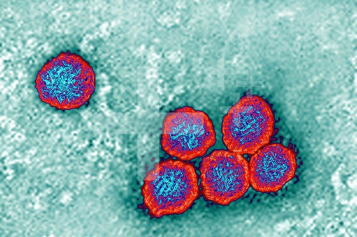 Flavivirus (Flaviviridae family), these viruses are responsible for yellow fever, dengue fever, Japanese encephalitis, Zika virus and West Nile encephalitis. They are transmitted by mosquitoes or ticks. Image made from transmission electron microscopy. Approximate viral diameter: 40 to 60 nm.