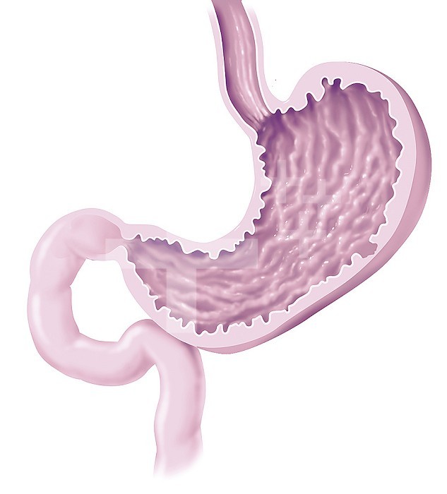 Stomach seen in section with duodenum. The stomach seen in section follows the esophagus at the top and ends with the pylorus. The digestive tract continues with the duodenum and then the beginning of the small intestine after the angle of Treitz.