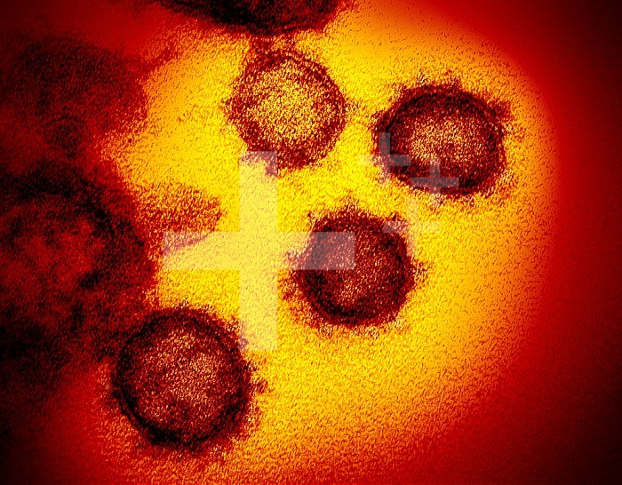 This transmission electron microscope image shows SARS-CoV-2—also known as 2019-nCoV, the virus that causes COVID-19—isolated from a patient in the U.S. Virus particles are shown emerging from the surface of cells cultured in the lab. The spikes on the outer edge of the virus particles give coronaviruses their name, crown-like.