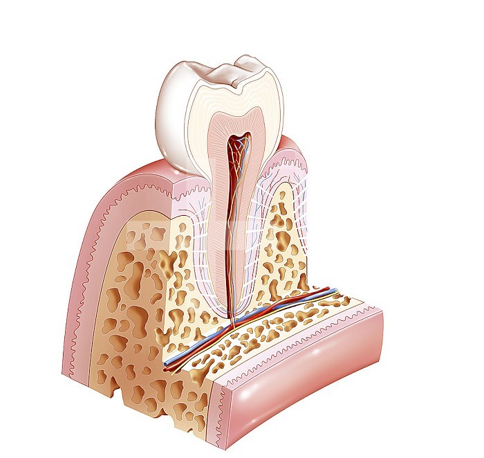 Healthy tooth (lower premolar). A tooth is made up externally of two parts: the crown, visible in the oral cavity and protected by enamel (in white), and the roots, implanted in the gum, a root for the lower premolars, in some cases, two roots . The tooth includes an internal cavity, the pulp chamber, filled with dental pulp (in brown), a connective tissue rich in blood and lymphatic vessels and nerve fibers. The pulp chamber continues at the root level through the root canal, through which the vessels and nerves enter. Dentin (pinkish beige) constitutes the major part of the tooth, and gives it its shape and rigidity, it is striated by numerous small channels, the dentinal tubules, which contain the ends of the nerves. The root is implanted in the maxilla, surrounded by the gum that covers the bone. Between the root and the bone, the root is surrounded by the cementum (in yellow) and the alveolar-dental ligament (in white).