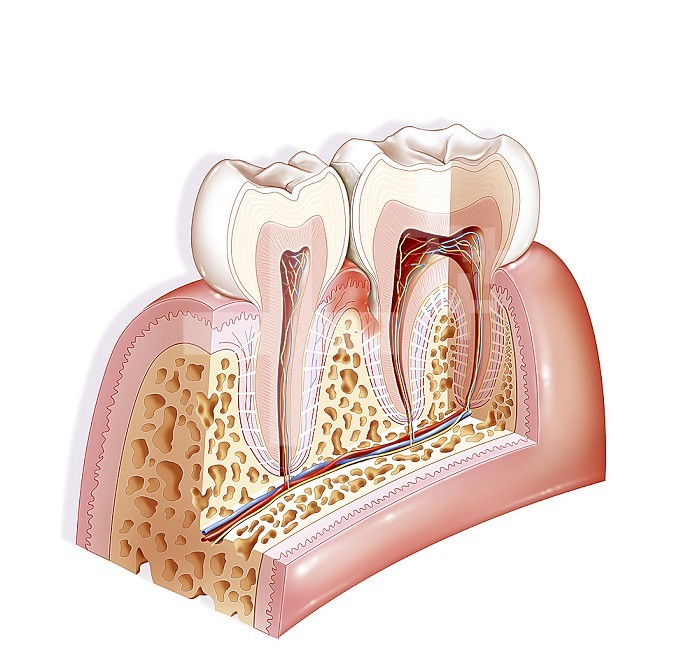 Periodontal pocket, a dental pathology. The periodontal pocket is a space that is created between the tooth and the gum during periodontal disease. It is caused by the destruction of the anchoring system of the tooth (the periodontium, supporting tissue of the tooth, including the bone) with the migration of the attachment of the gum along the tooth towards the end of the tooth. root. In this pocket will accumulate aggressive bacteria for the periodontium and entrenched by a simple brushing.
