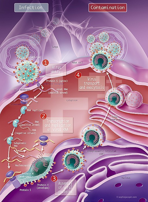 Coronavirus replication, CoVid-19, SARS-Cov2. This scientific illustration explains how the 2019 coronavirus replicates thanks to a host cell. FUSION: When the virus reaches the respiratory system by inhalation, it fuses with a host cell thanks to its protein S (spicule), viral surface protein and a membrane receptor of the host cell. TRANSLATION: Viral RNA (positive strand) binds to ribosomes. It is transcribed to form an RNA replicase which will make RNA (negative strand) from RNA (positive strand). TRANSLATION: Viral RNA (positive strand) binds to ribosomes. It is transcribed to form an RNA replicase which will make RNA (negative strand) from RNA (positive strand). TRANSCRIPTION.ET REPLICATION: This negative strand is used to make RNA under genomics It allows to replicate viral RNA (positive strand). TRANSLATION:. Thanks to the ribosomes of the host cell, the viral RNA (positive strand) produces the viral proteins (N, M, E and S) which fuse with the endoplasmic membrane. The latter invades around the nucleocapsid to constitute the new viral offspring. TRANSPORT: Viral offspring encapsulated and transported by golgian vesicles to the cell membrane. EXOCYTOSIS: Viral offspring are outsourced outside the host cell.