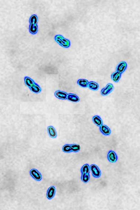 Pneumococcal bacteria (streptococcus pneumoniae). Pneumococcus is an important pathogen in humans. It is responsible for many infections (pneumonia). He was responsible for pneumonia during the Spanish flu pandemic). Visualized by optical microscopy. .