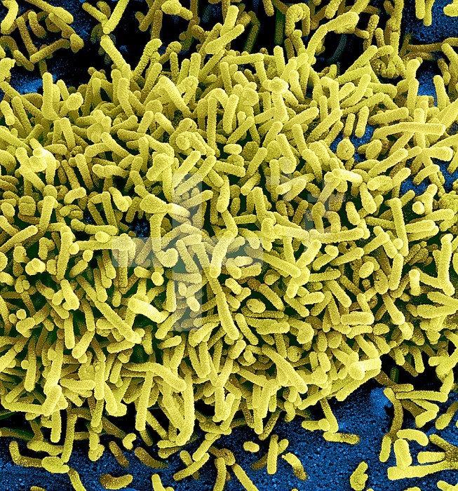 Colorized scanning electron micrograph of Marburg virus particles (yellow) both budding and attached to the surface of infected VERO E6 cells (blue). Image captured and color-enhanced at the NIAID Integrated Research Facility in Fort Detrick, Maryland. Credit: NIAID.