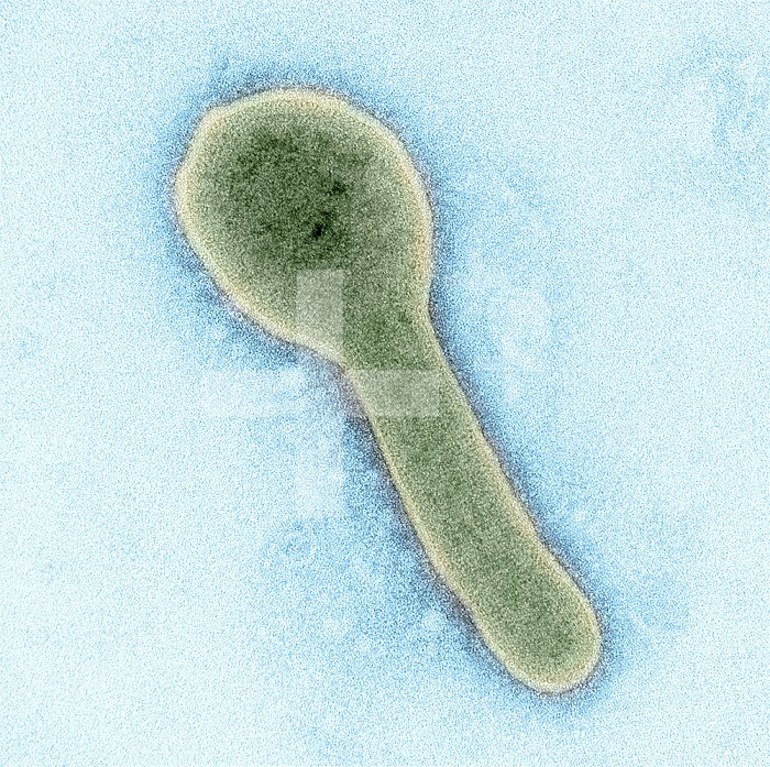 Colorized transmission electron micrograph of a Marburg virus particle (green) harvested from infected VERO E6 cell supernatant. Image captured and color-enhanced at the NIAID Integrated Research Facility in Fort Detrick, Maryland. Credit: NIAID.