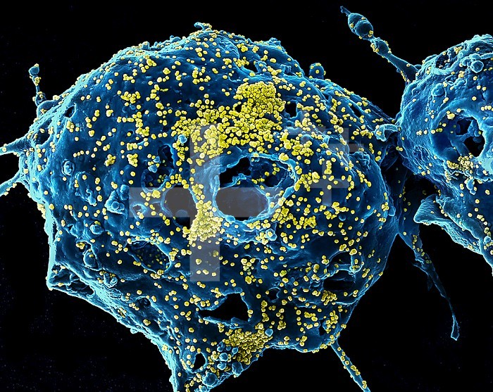 Colorized scanning electron micrograph of Middle East Respiratory Syndrome virus particles (yellow) attached to the surface of an infected VERO E6 cell (blue). Image captured and color-enhanced at the NIAID Integrated Research Facility in Fort Detrick, Maryland. Credit: NIAID.