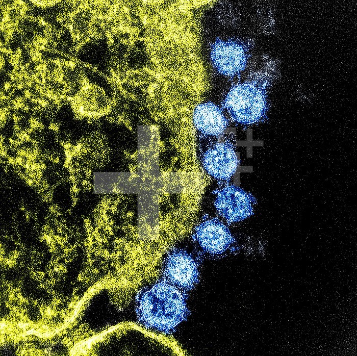 Colorized transmission electron micrograph of Middle East Respiratory Syndrome virus particles (blue) found near the periphery of an infected VERO E6 cell (yellow). Image captured and color-enhanced at the NIAID Integrated Research Facility in Fort Detrick, Maryland. Credit: NIAID.