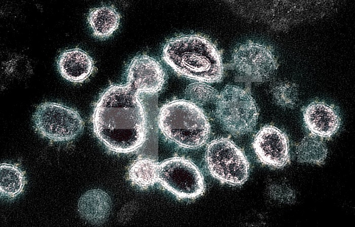 This transmission electron microscope image shows SARS-CoV-2, the virus that causes COVID-19, isolated from a patient in the U.S. Virus particles are shown emerging from the surface of cells cultured in the lab. The spikes on the outer edge of the virus particles give coronaviruses their name, crown-like. Image captured and colorized at NIAID´s Rocky Mountain Laboratories (RML) in Hamilton, Montana. Credit: NIAID.
