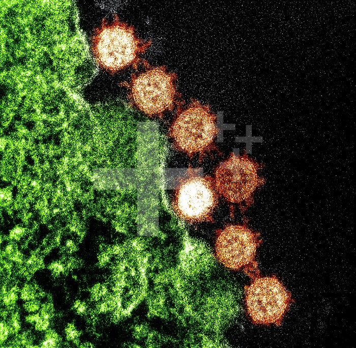 Colorized transmission electron micrograph of Severe Acute Respiratory Syndrome (SARS) virus particles (orange) found near the periphery of an infected cell (green). Image captured and color-enhanced at the NIAID Integrated Research Facility in Fort Detrick, Maryland. Credit: NIAID.