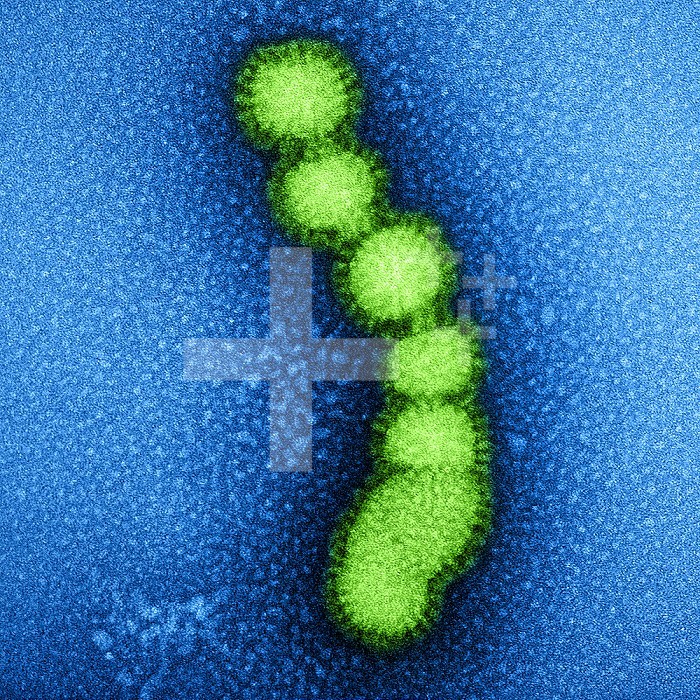 Colorized transmission electron micrograph of negatively stained SW31 (swine strain) influenza virus particles. Credit: NIAID.