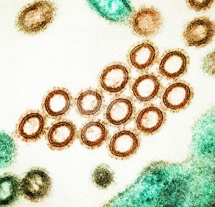 Colorized transmission electron micrograph of a cross-section of SW31 (swine strain) influenza virus particles (orange) found near the surface of an infected MDCK cell (green). Image captured and color-enhanced at the NIAID Integrated Research Facility in Fort Detrick, Maryland. Credit: NIAID.