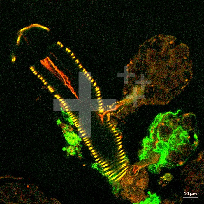 This confocal microscope image shows a cross section of a tick salivary gland infected with Langat virus (green). Two rounded structures on the right, called acini, are shown attached to a duct (yellow). The lower acinus is infected, as denoted by the green fluorescent signal. Credit: NIAID.