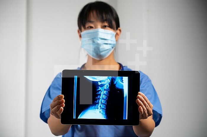 Female doctor holding a screen with x-ray of cervical vertebrae