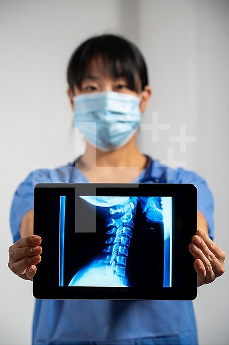 Female doctor holding a screen with x-ray of cervical vertebrae