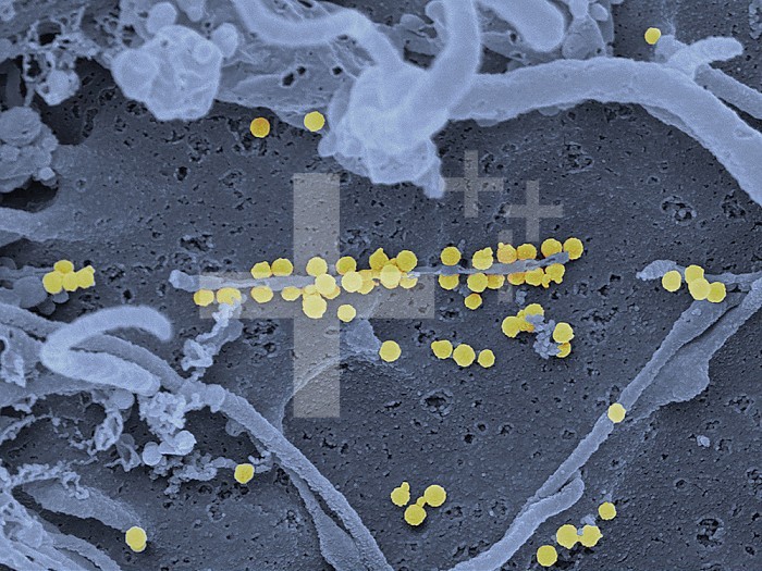 Scanning electron micrograph of Crimean-Congo hemorrhagic fever (CCHF) viral particles (yellow) budding from the surface of cultured epithelial cells from a patient. Credit: NIAID.