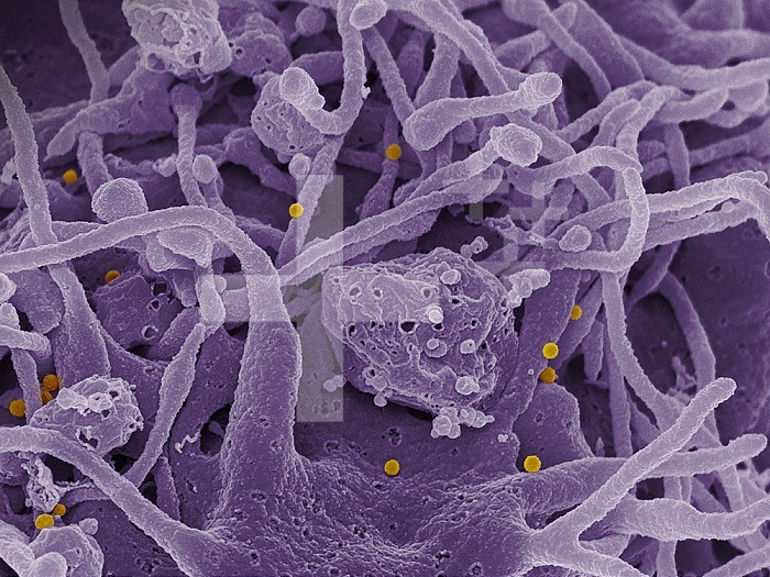 Scanning electron micrograph of Crimean-Congo hemorrhagic fever (CCHF) viral particles (yellow) budding from the surface of cultured epithelial cells from a patient. Credit: NIAID.