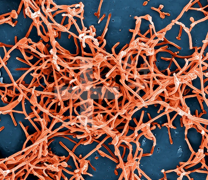 Colorized scanning electron micrograph of Ebola virus particles (red) in extracellular space between infected African green monkey kidney cells. Image captured and color-enhanced at the NIAID Integrated Research Facility in Ft. Detrick, Maryland. Credit: NIAID.