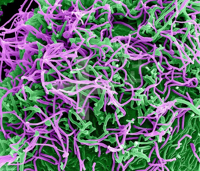 Colorized transmission electron micrograph of Ebola virus particles (purple) attached to and budding from an infected VERO E6 cell (green). Image captured and color-enhanced at the NIAID Integrated Research Facility in Fort Detrick, Maryland. Credit: NIAID.