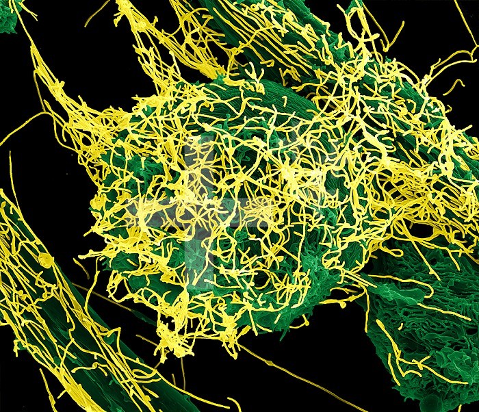 Colorized scanning electron micrograph of Ebola virus particles (yellow) both budding and attached to the surface of infected VERO E6 cells (green). Image captured and color-enhanced at the NIAID Integrated Research Facility in Fort Detrick, Maryland. Credit: NIAID.