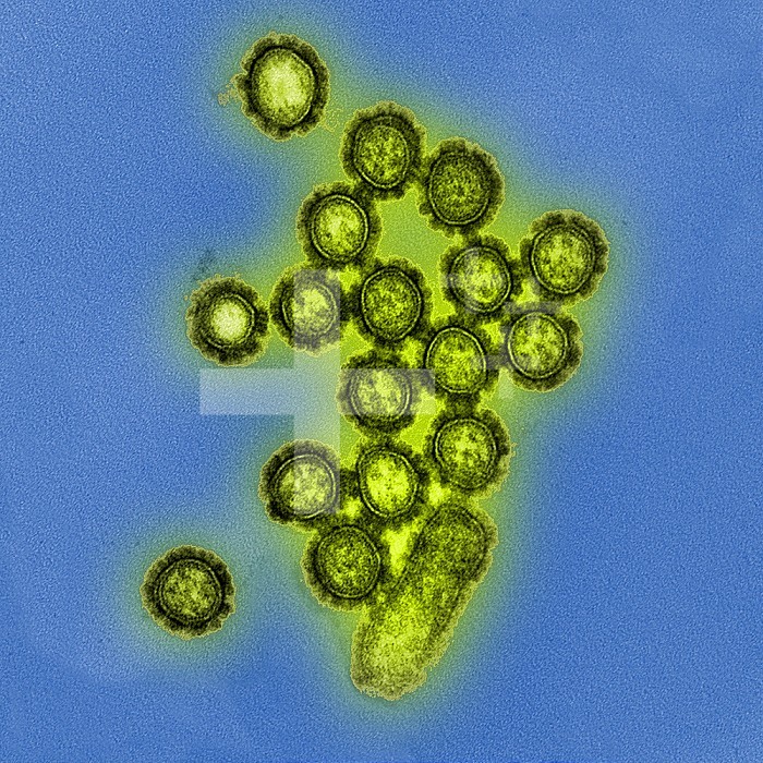 Colorized transmission electron micrograph showing H1N1 influenza virus particles. Surface proteins on the virus particles are shown in black. Credit: NIAID.