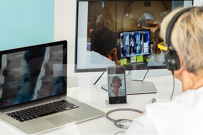 Teleconsultation between two doctors with medical images of the spine on one of the screens and team around a scanner on the other.