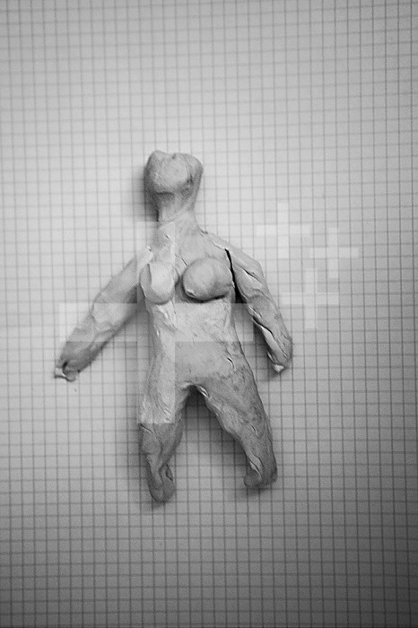 Anorexia of a woman who followed a psychomotricity session where she must represent herself in plasticine.