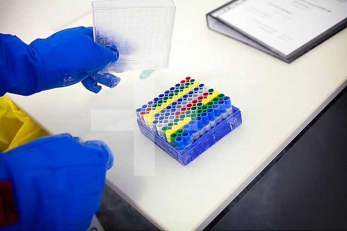 Laboratory analyzes and results to test the effectiveness of an AIDS vaccine.
