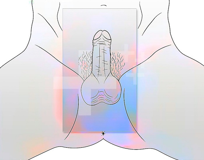 Male external genitalia showing the penis. .