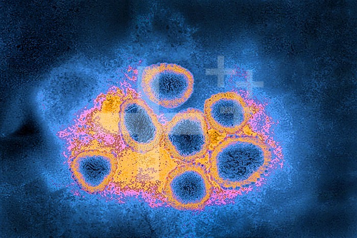 Coronavirus (CoV). viruses of the Coronaviridae family and the Orthocoronavirinae subfamily. It is a pathogen of respiratory syndromes. Viewed from a transmission electron microscopy (TEM) image. Viral diameter 80nm to 100nm.