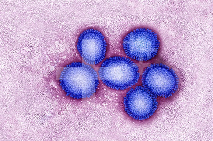 Fluvirus - Influenza virus or Influenza virus. The influenza virus causes the seasonal flu, with in humans, a set of symptoms associating: fever, headache, cough, pharyngitis, myalgia, asthenia and anorexia. View produced from a transmission electron microscopy view. Viral diameter approximately: 80 to 120 nm.