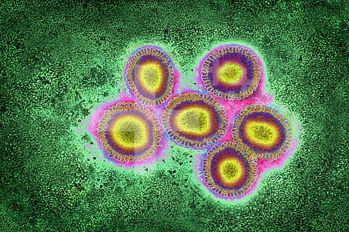 Fluvirus - Influenza virus or Influenza virus. The influenza virus causes the seasonal flu, with in humans, a set of symptoms associating: fever, headache, cough, pharyngitis, myalgia, asthenia and anorexia. View produced from a transmission electron microscopy view. Viral diameter approximately: 80 to 120 nm.