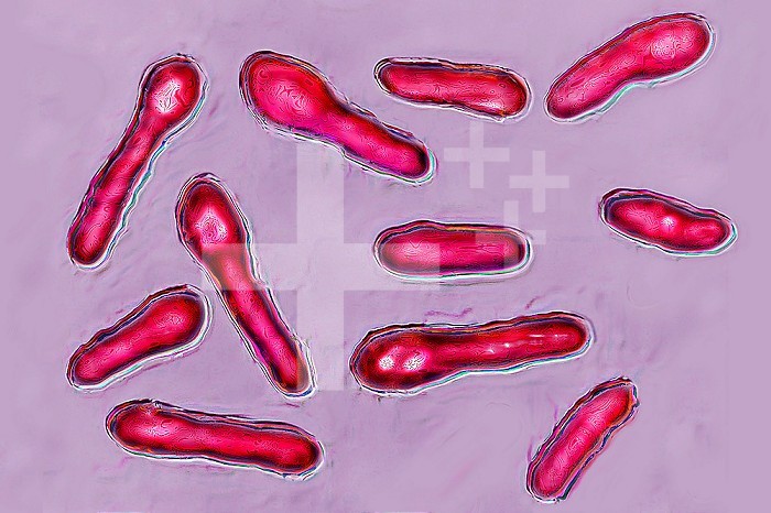 Clostridium botulinum or botulinum bacillus is a bacterium that secretes botox, a toxin that inhibits the neurons responsible for muscle contraction. By localized injection, the toxin reduces wrinkles by paralyzing the muscles causing wrinkles. Colorization and HDRI treatments on X 1000 optical microscopy.
