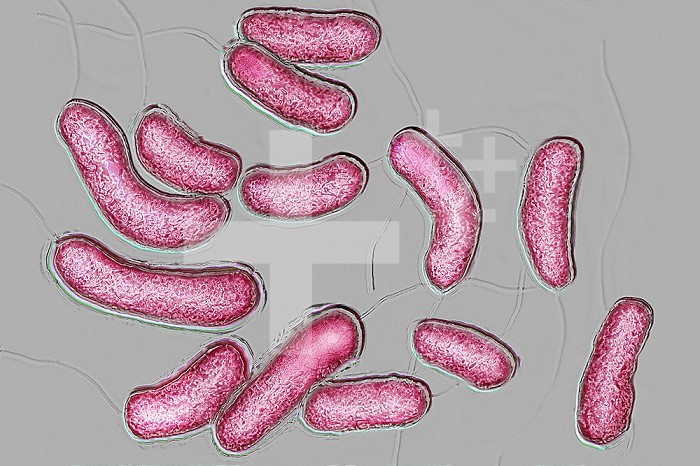 Bacilli Vibrio cholera. Cholera is an infectious and contagious disease, characterized by sudden diarrhea. Left untreated, the main form of cholera is fatal. Image taken from an X 1000 optical microscopy view.