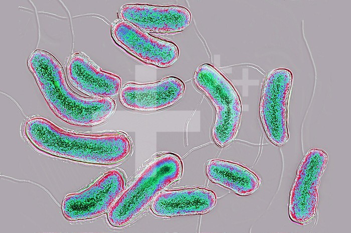 Bacilli Vibrio cholera. Cholera is an infectious and contagious disease, characterized by sudden diarrhea. Left untreated, the main form of cholera is fatal. Image taken from an X 1000 optical microscopy view.
