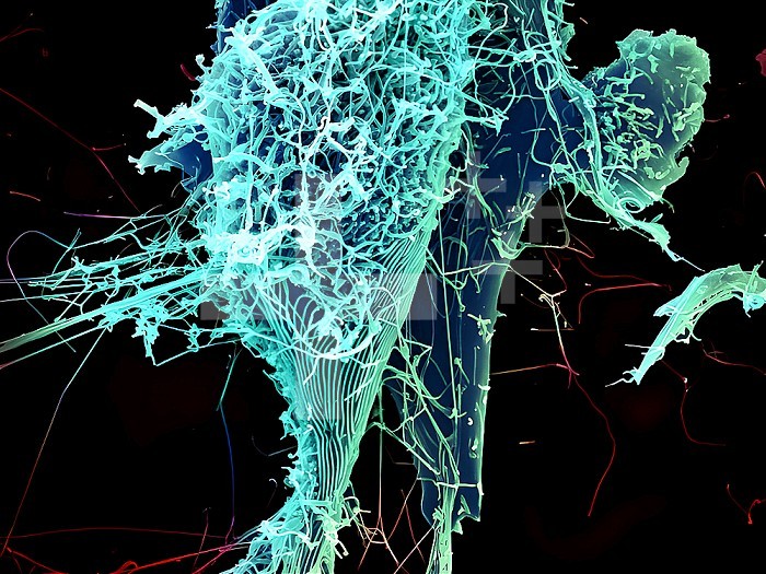 String-like Ebola virus particles are shedding from an infected cell in this electron micrograph.