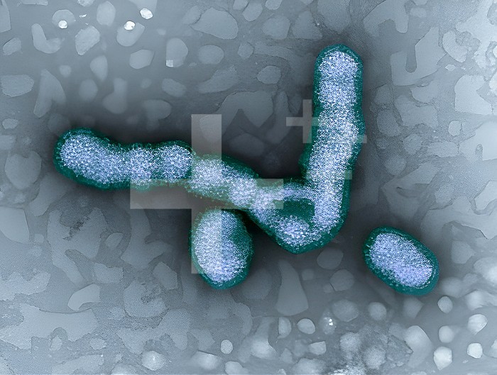 Transmission electron micrograph of H1N1 virus particles.