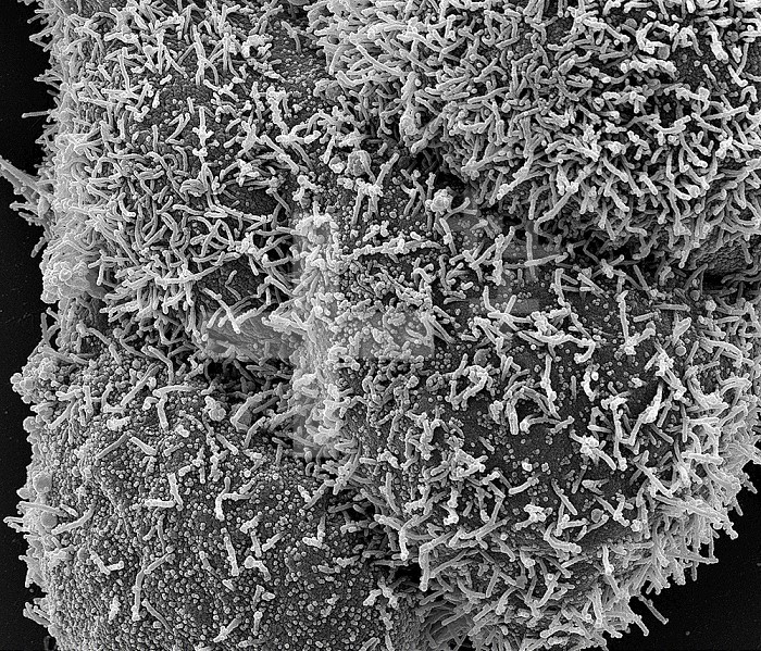 CCL-81 cells heavily infected with SARS-CoV-2 virus particles. The small spherical structures are SARS-CoV-2 virus particles. The string-like protrusions extending from the cells are cell projections or pseudopodium. Image captured at the NIAID Integrated Research Facility (IRF) in Fort Detrick, Maryland.