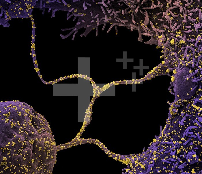 Colorized scanning electron micrograph of CCL-81 cells (purple) infected with SARS-CoV-2 virus particles (yellow), isolated from a patient sample. The tentacle-like protrusions from the cells are filapodia, which extend from infected cells, attach to neighboring cells, and promote viral infection as a transport system for virus particles. Image captured at the NIAID Integrated Research Facility (IRF) in Fort Detrick, Maryland.