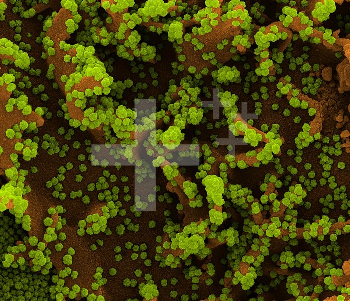 Colorized scanning electron micrograph of a cell (brown) heavily infected with SARS-CoV-2 virus particles (green), isolated from a patient sample. Image captured at the NIAID Integrated Research Facility (IRF) in Fort Detrick, Maryland.