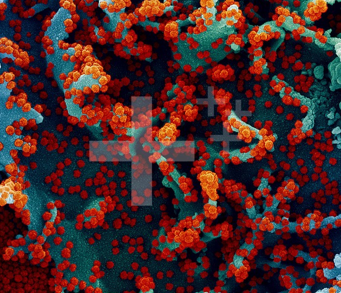 Colorized scanning electron micrograph of a cell heavily infected with SARS-CoV-2 virus particles (red), isolated from a patient sample. Image captured at the NIAID Integrated Research Facility (IRF) in Fort Detrick, Maryland.