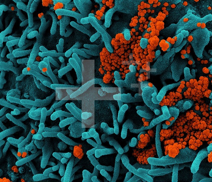 Colorized scanning electron micrograph of a cell (teal) infected with SARS-CoV-2 virus particles (orange), isolated from a patient sample. Image captured at the NIAID Integrated Research Facility (IRF) in Fort Detrick, Maryland.