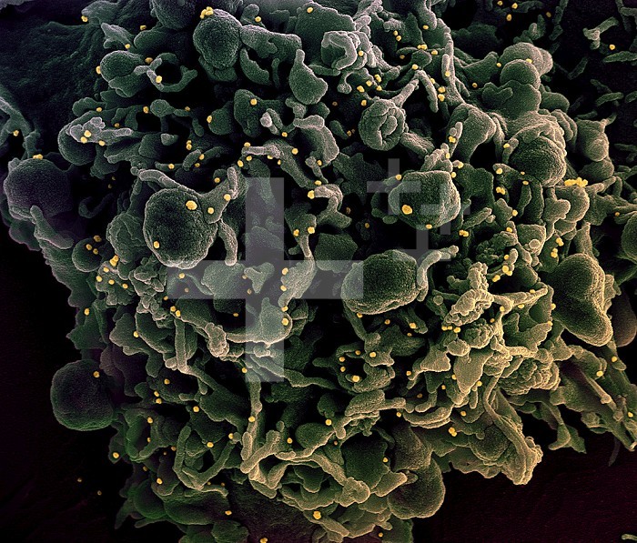 Colorized scanning electron micrograph of a cell infected with SARS-CoV-2 virus particles (yellow), isolated from a patient sample. Image captured at the NIAID Integrated Research Facility (IRF) in Fort Detrick, Maryland.