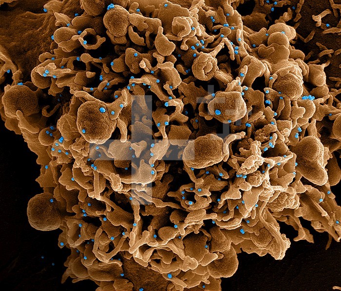 Colorized scanning electron micrograph of a cell (brown) infected with SARS-CoV-2 virus particles (blue), isolated from a patient sample. Image captured at the NIAID Integrated Research Facility (IRF) in Fort Detrick, Maryland.
