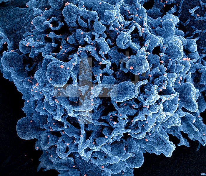 Colorized scanning electron micrograph of a cell (blue) infected with SARS-CoV-2 virus particles (pink), isolated from a patient sample. Image captured at the NIAID Integrated Research Facility (IRF) in Fort Detrick, Maryland.