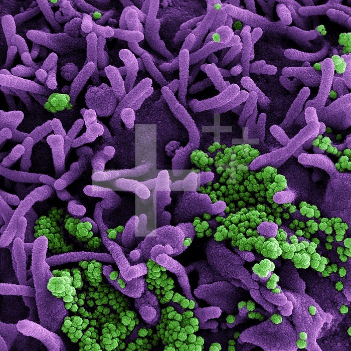 Colorized scanning electron micrograph of a cell (purple) infected with SARS-CoV-2 virus particles (green), isolated from a patient sample. Image captured at the NIAID Integrated Research Facility (IRF) in Fort Detrick, Maryland.