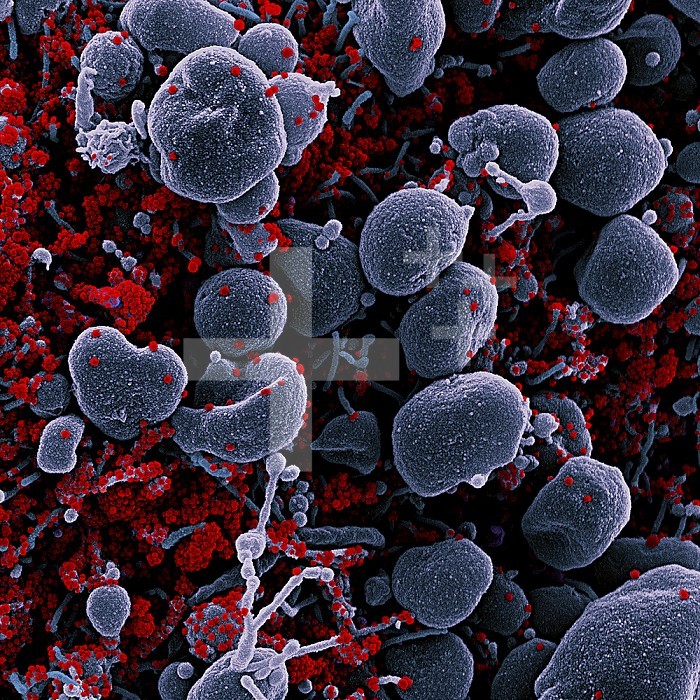 Colorized scanning electron micrograph of an apoptotic cell (gray) heavily infected with SARS-CoV-2 virus particles (red), isolated from a patient sample. Image captured at the NIAID Integrated Research Facility (IRF) in Fort Detrick, Maryland.