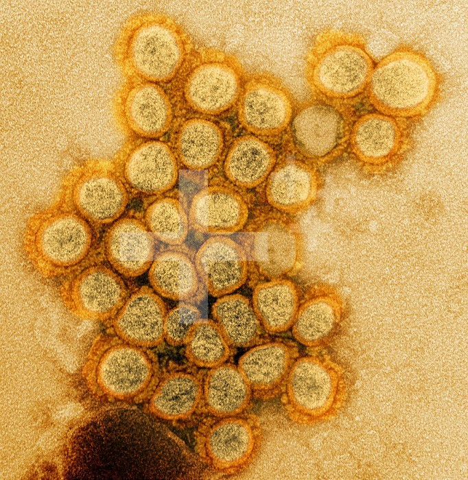 Transmission electron micrograph of a variant strain of SARS-CoV-2 virus particles (UK B.1.1.7), isolated from a patient sample and cultivated in cell culture. Image captured at the NIAID Integrated Research Facility (IRF) in Fort Detrick, Maryland.