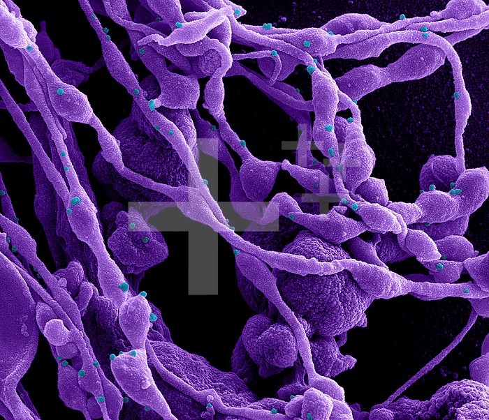 Colorized scanning electron micrograph of a cell (purple) infected with SARS-CoV-2 virus particles (blue), isolated from a patient sample. Image captured at the NIAID Integrated Research Facility (IRF) in Fort Detrick, Maryland.