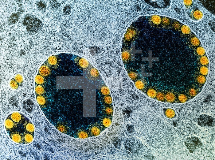 Transmission electron micrograph of SARS-CoV-2 virus particles (yellow) within endosomes of a heavily infected nasal Olfactory Epithelial Cell. Image captured at the NIAID Integrated Research Facility (IRF) in Fort Detrick, Maryland.
