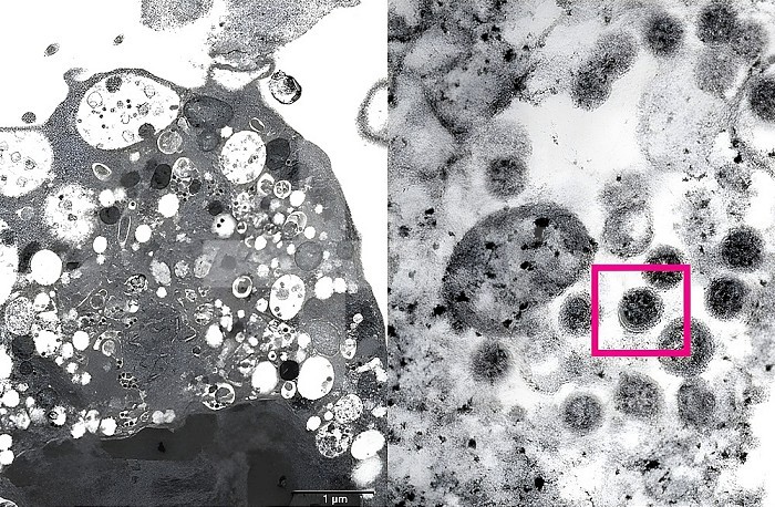 Left: Low magnification electron micrograph of a monkey kidney cell (Vero E6) after infection with the SARS-CoV-2 Omicron variant showing cell damage with swollen vesicles containing small black viral particles and on the right: Electron micrograph at high magnification of an infected Vero E6 cell showing aggregates of viral particles with crown-shaped spikes on their surface (red box).